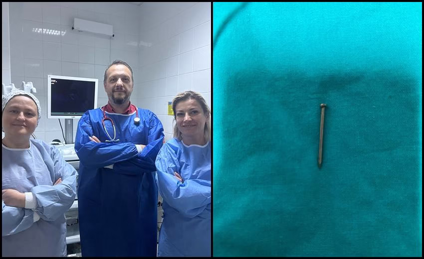 2 Yaşındaki Çocuğun Midesinden Yuttuğu Çivi Endoskopik Yöntemle Çıkarıldı